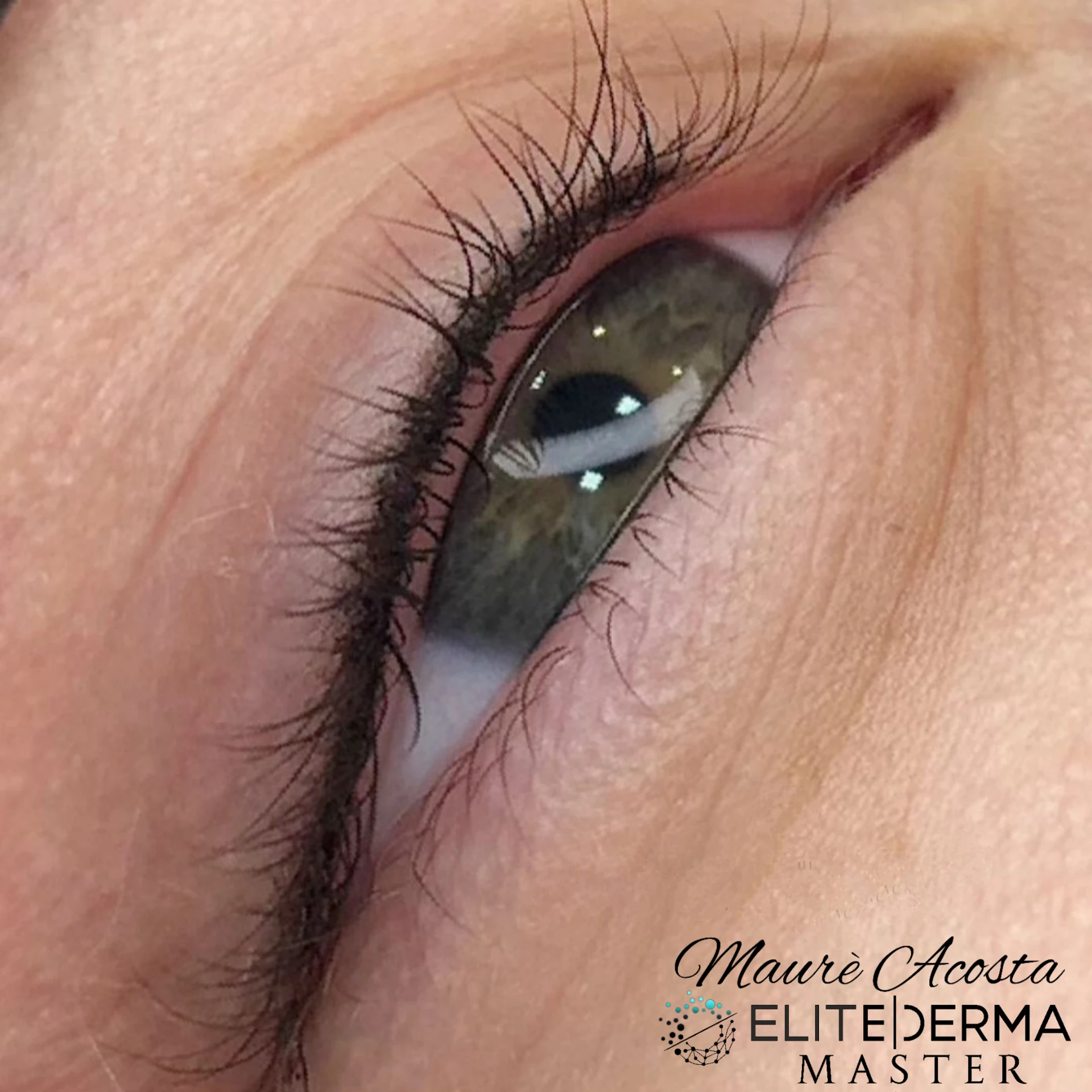 Lash-Line Enhancement