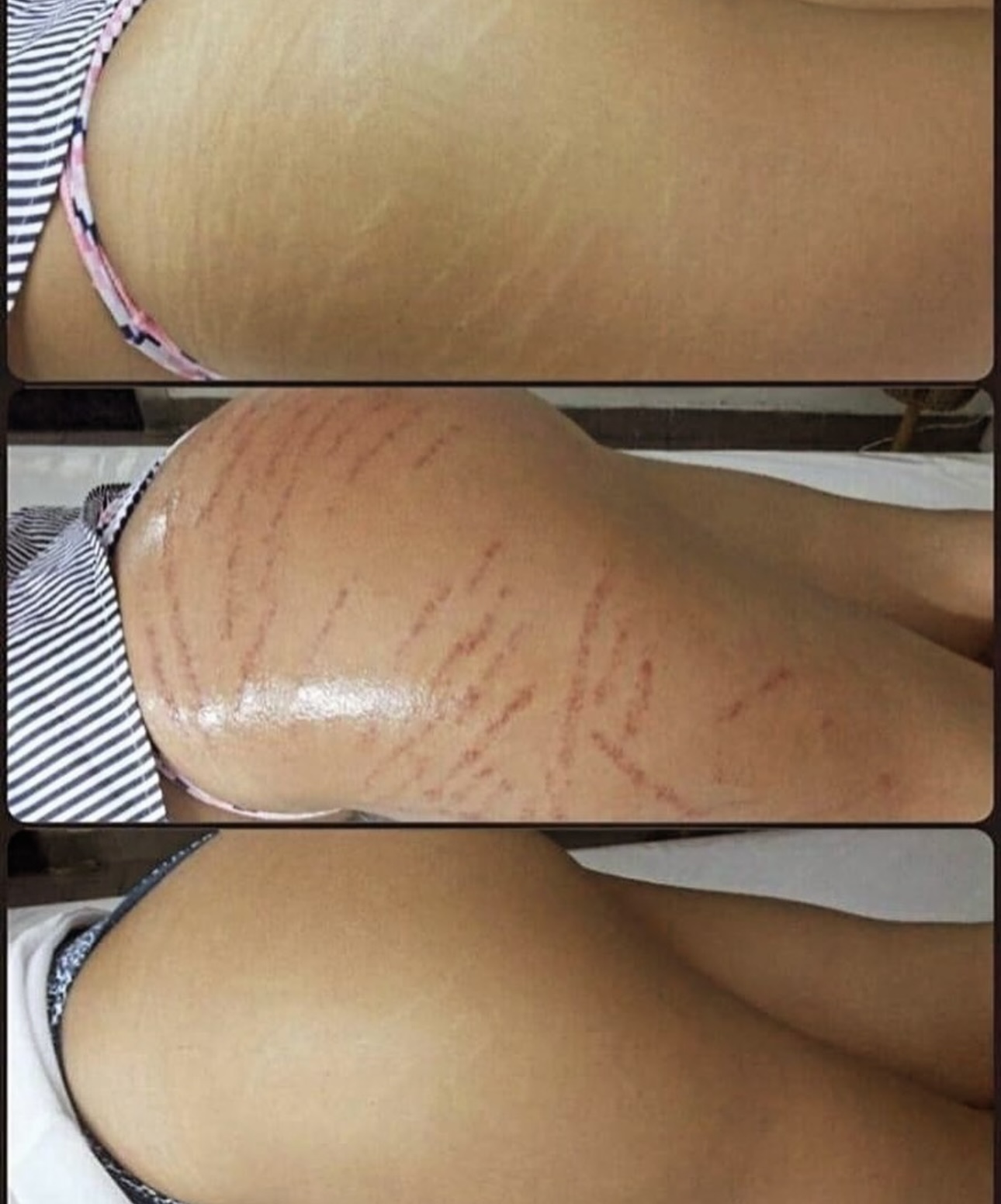 EsteticaAvanzata