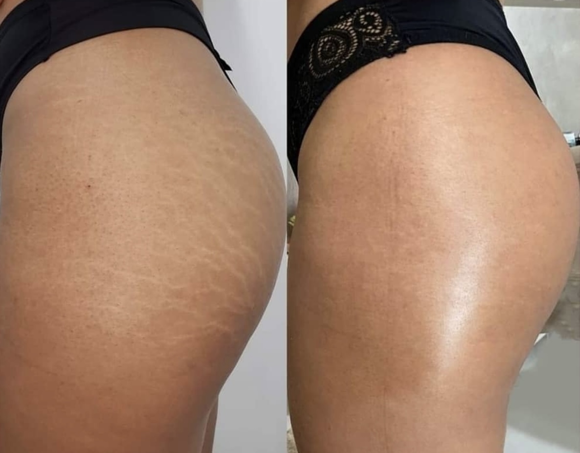 EsteticaAvanzata