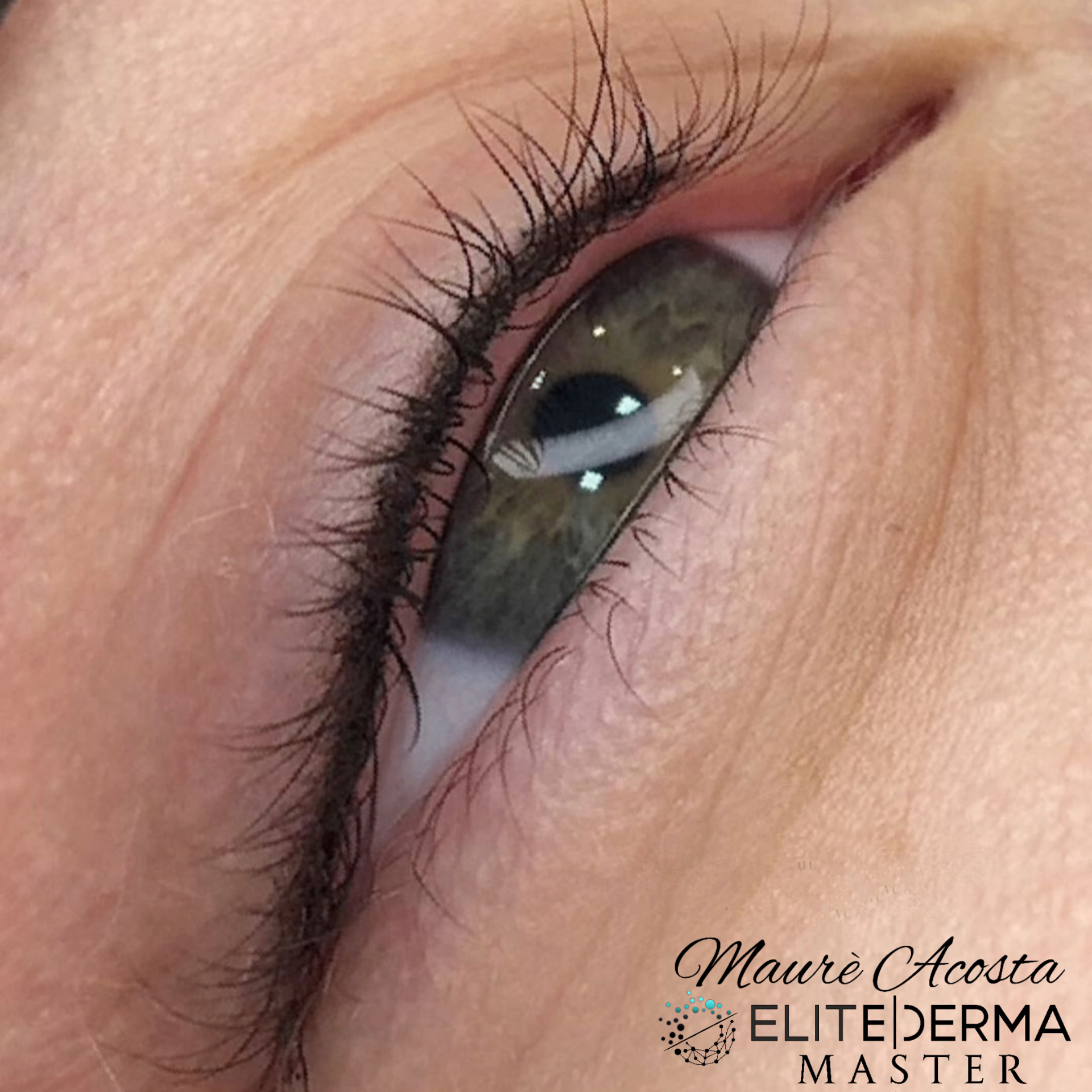Lash-Line Enhancement