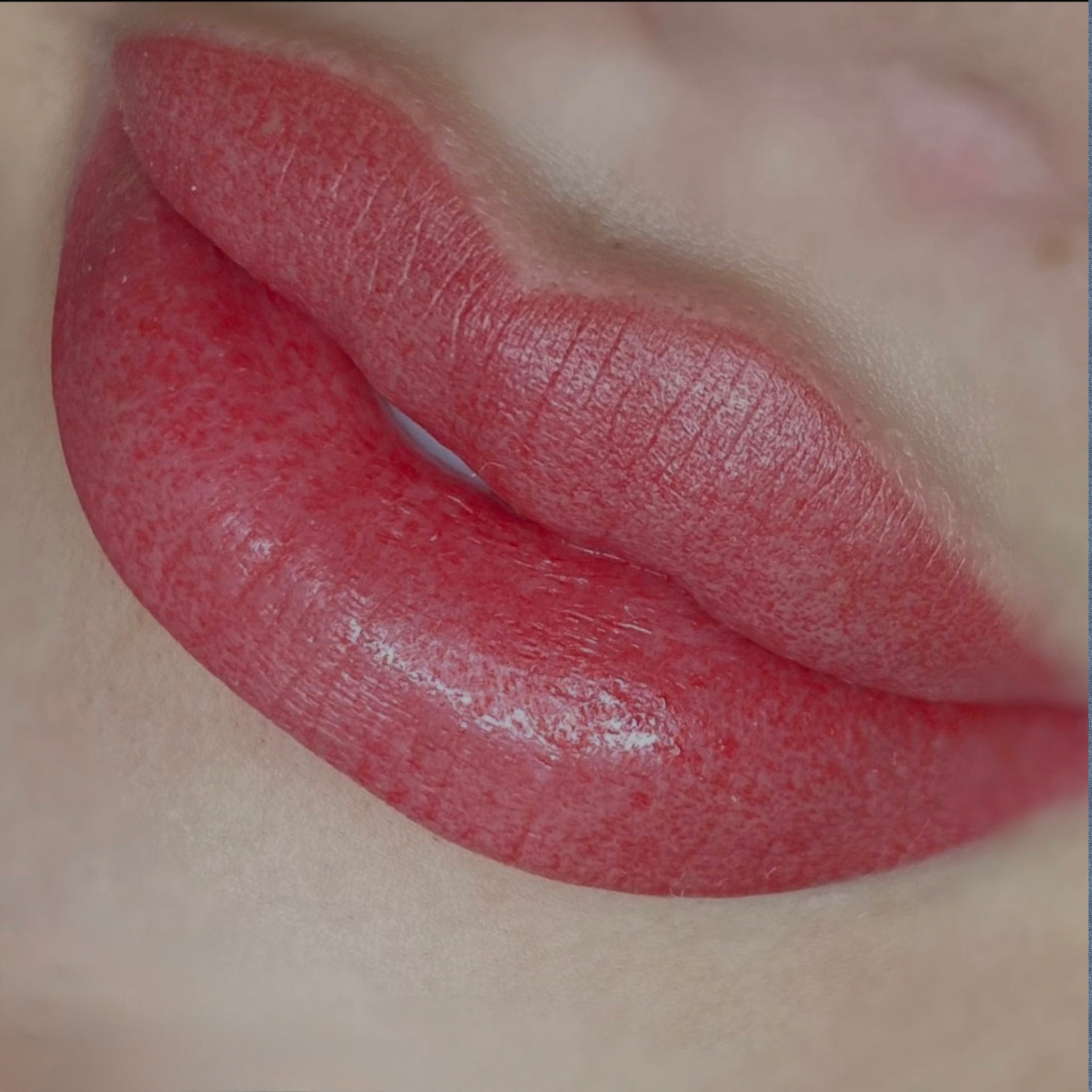 Full Lips