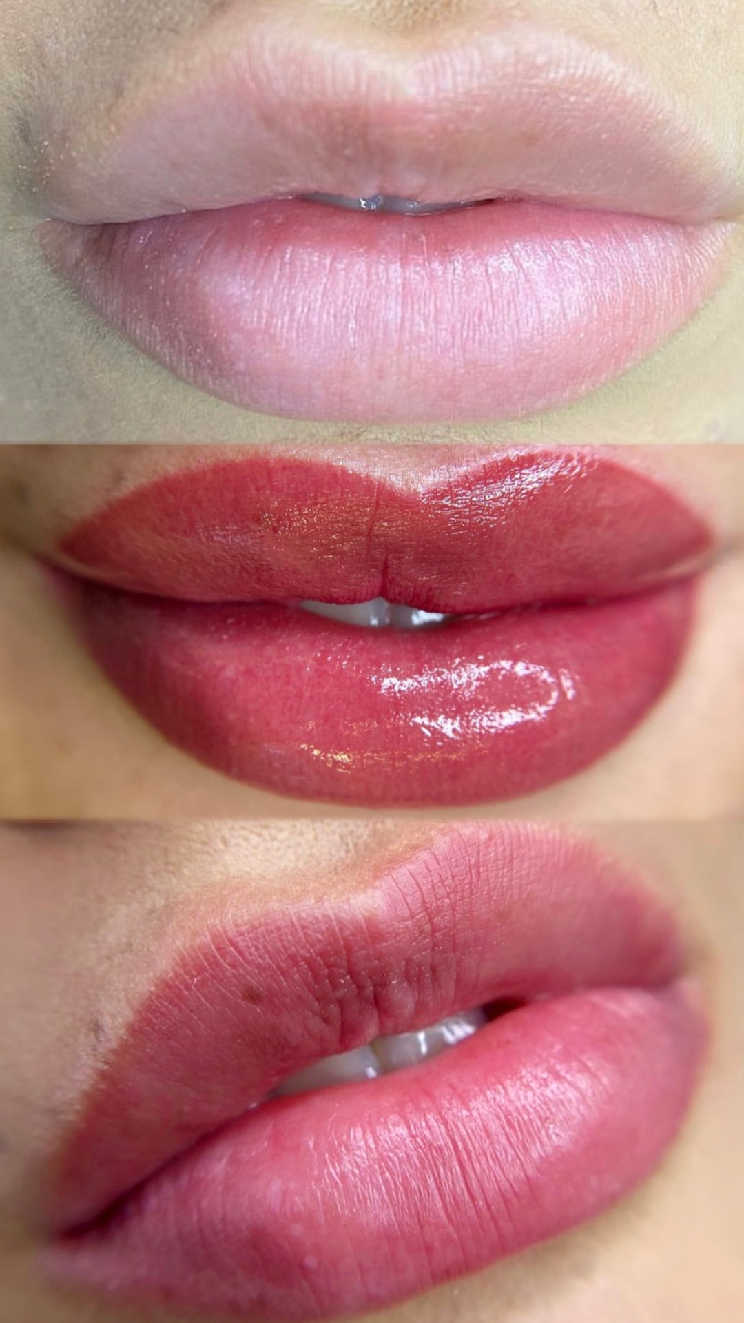 3D Lips