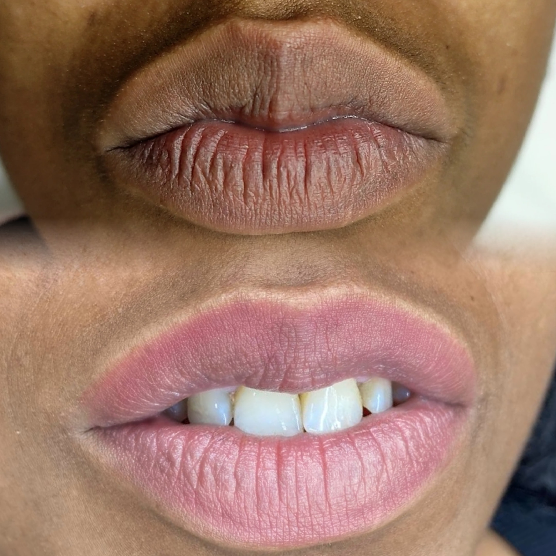Full Lips